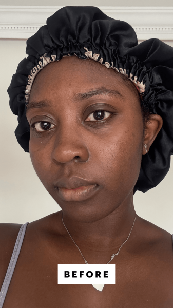 BlayTettey before applying the  Dr. Diamonds Metacine Instafacial Plasma